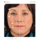 Nu Skin ageLOC procedūriniai veido geliai