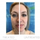 Nu Skin LumiSpa Idealeyes